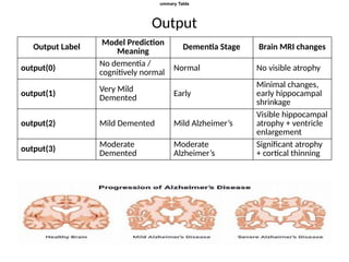 Explainable Deep Learning Framework for Early Alzheimer's Disease ...