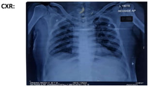 CXR:
 