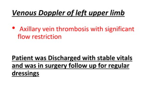 Venous Doppler of left upper limb
• Axillary vein thrombosis with significant
flow restriction
Patient was Discharged with stable vitals
and was in surgery follow up for regular
dressings
 