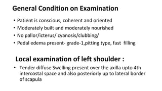 General Condition on Examination
• Patient is conscious, coherent and oriented
• Moderately built and moderately nourished
• No pallor/icterus/ cyanosis/clubbing/
• Pedal edema present- grade-1,pitting type, fast filling
Local examination of left shoulder :
• Tender diffuse Swelling present over the axilla upto 4th
intercostal space and also posteriorly up to lateral border
of scapula
 
