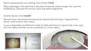 Recent advancements are evolving. One of them FLACS.
Major advantage is the potential to decrease intraocular phaco energy time, save the
endothelium, decrease the zonular stress and tackle astigmatism.
Another device is the miLOOP-
Manual micro-interventional endocapsular disassembly technique. Fragmentation
device. Used to bisect the nucleus.
It uses a disposable microfilament made of nickel and titanium ring (nitinol). It can open
10.5 mm radius and then can be contracted to 1.5 mm radius.
 