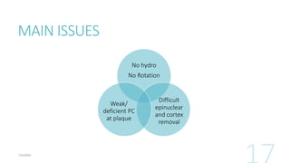 MAIN ISSUES
No hydro
No Rotation
Difficult
epinuclear
and cortex
removal
Weak/
deficient PC
at plaque
 