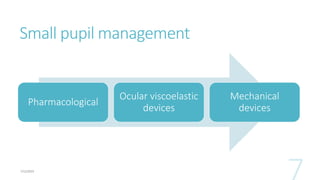 Small pupil management
Pharmacological
Ocular viscoelastic
devices
Mechanical
devices
 