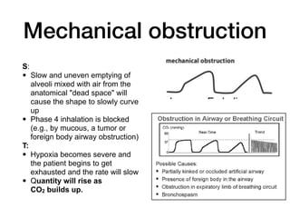 Obstructive Pattern Capnography Capnography in emergency room | PDF