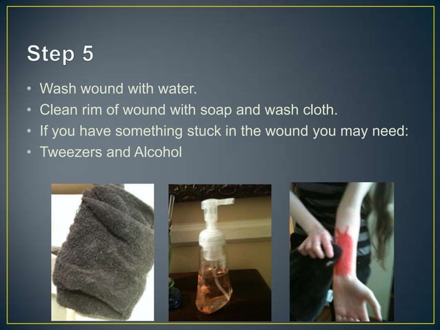 First Aid Presentation: Minor Burn and Moderate Road Rash | PPT