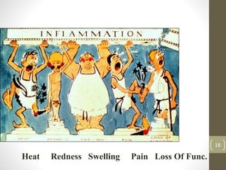 18
Heat Redness Swelling Pain Loss Of Func.
 