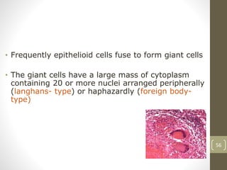 56
• Frequently epithelioid cells fuse to form giant cells
• The giant cells have a large mass of cytoplasm
containing 20 or more nuclei arranged peripherally
(langhans- type) or haphazardly (foreign body-
type)
 