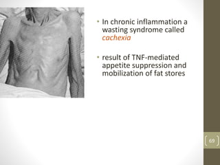 • In chronic inflammation a
wasting syndrome called
cachexia
• result of TNF-mediated
appetite suppression and
mobilization of fat stores
69
 