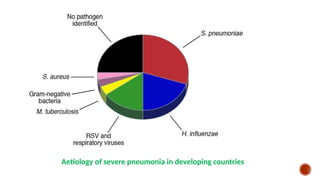 Aetiology of severe pneumonia in developing countries
 