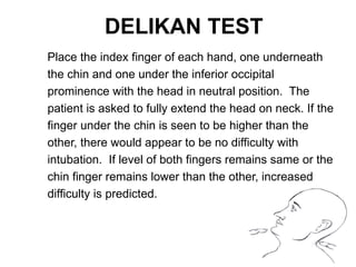 Delikan Test EDITED PPT anesthesia AIRWAY ASSESSMENT.pptx