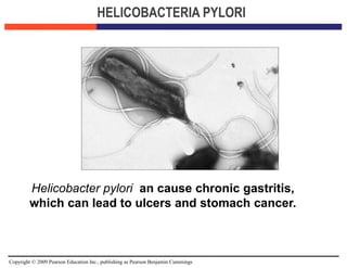 Copyright © 2009 Pearson Education Inc., publishing as Pearson Benjamin Cummings
HELICOBACTERIA PYLORI
Helicobacter pylori an cause chronic gastritis,
which can lead to ulcers and stomach cancer.
 