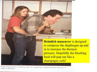 Heimlich maneuver  is designed to compress the diaphragm up and in to increase the thoracic pressure. Hopefully the blocking food will pop out like a champagne cork! 