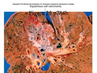 Figure 25.p784b 
