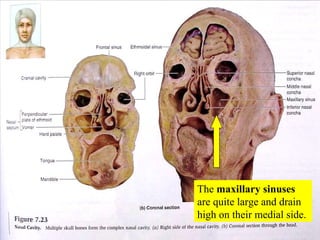 The  maxillary sinuses  are quite large and drain high on their medial side. 