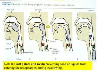 Note the  soft palate and uvula  preventing food or liquids from entering the nasopharynx during swallowing. 