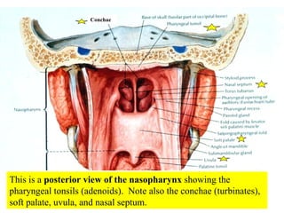 This is a  posterior view of the nasopharynx  showing the pharyngeal tonsils (adenoids).  Note also the conchae (turbinates), soft palate, uvula, and nasal septum. Conchae 