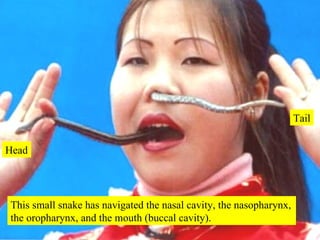 This small snake has navigated the nasal cavity, the nasopharynx, the oropharynx, and the mouth (buccal cavity). Head Tail 