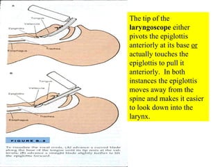 The tip of the  laryngoscope  either pivots the epiglottis anteriorly at its base  or  actually touches the epiglottis to pull it anteriorly.  In both instances the epiglottis moves away from the spine and makes it easier to look down into the larynx. 