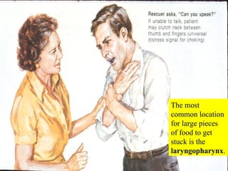 The most common location for large pieces of food to get stuck is the  laryngopharynx . 