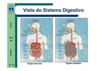 ITORA
    ED




UT

               A
                   Vista do Sistema Digestivo
A




  A D E S OU Z
     Passe




    Aula
     06
     O Passe




                    Órgãos Normais   Órgãos Afetados
12 / 12
 