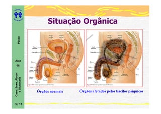 ITORA
    ED




                                  Situação Orgânica
UT

                         A
A




  A D E S OU Z
           Passe




    Aula
       08
    Caso: Sexo, Álcool
       e Glutonaria




                             Órgãos normais   Órgãos afetados pelos bacilos psíquicos


    3 / 13
 