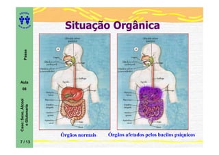 ITORA
    ED




UT

                         A
                              Situação Orgânica
A




  A D E S OU Z
           Passe




    Aula
       08
    Caso: Sexo, Álcool
       e Glutonaria




                             Órgãos normais   Órgãos afetados pelos bacilos psíquicos
    7 / 13
 