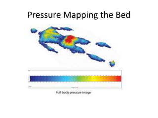 Pressure Mapping the Bed
 