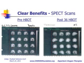 Binds to active neurons