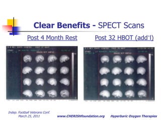 View function, not structure