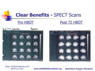 Compares CNS metabolism 			before & after HBOT