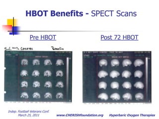 View function, not structure