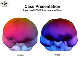 Indep. Football Veterans Conf.  March 25, 2011Hyperbaric Oxygen TherapiesHBO Effect on Blood O2 Contentat 2.4 ATA HBOT delivers O2 = HbO2 desaturationHBOT creates high O2 gradient & O2 activity