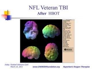 Indep. Football Veterans Conf.  March 25, 2011Hyperbaric Oxygen TherapiesHBOT Benefits - SPECT ScansPre HBOTPost 72 HBOT