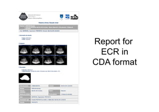 Report for 
ECR in 
CDA format 
 
