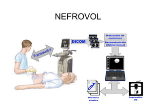 NEFROVOL 
 