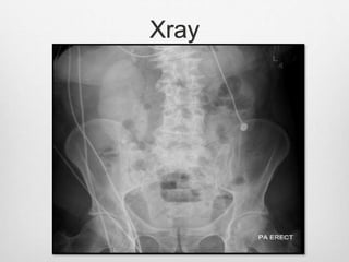 Xray
 
