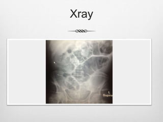 Xray
 