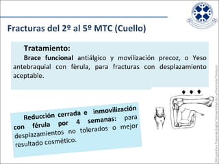 Tratamiento:   Brace funcional  antiálgico y movilización precoz, o Yeso antebraquial con fèrula, para fracturas con desplazamiento aceptable. Fracturas del 2º al 5º MTC (Cuello) 