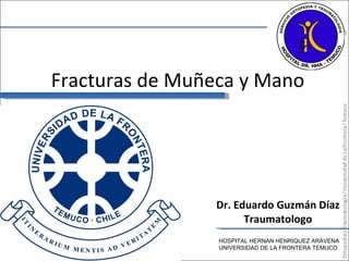 Fracturas de Muñeca y Mano Dr. Eduardo Guzmán Díaz Traumatologo HOSPITAL HERNAN HENRIQUEZ ARAVENA UNIVERSIDAD DE LA FRONTERA TEMUCO 