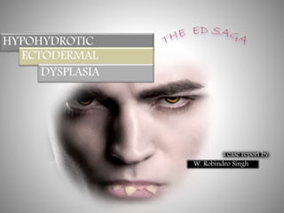 HYPOHYDROTIC
ECTODERMAL
DYSPLASIA
W. Robindro Singh
a case report by
 