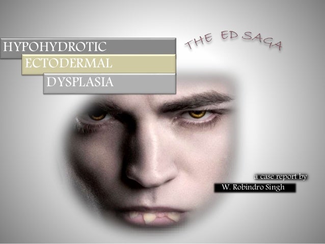 Ectodermal Dysplasia Syndrome