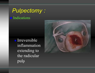 Pulpuctomy pulpectomy in primary dentition is very important skill.in this seminar ...