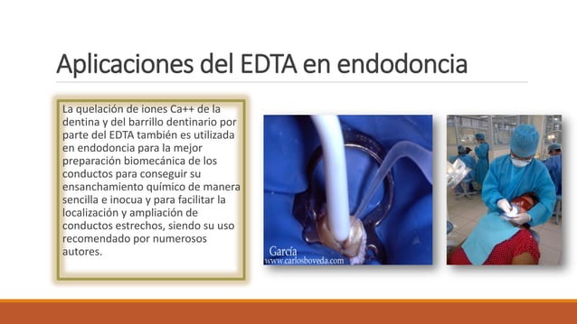 Edta conductos curvos y calcificados