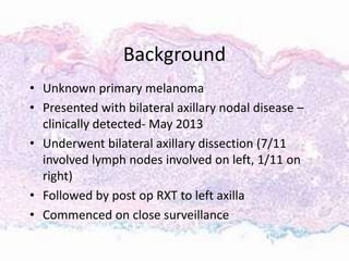 Background
• Unknown primary melanoma
• Presented with bilateral axillary nodal disease –
clinically detected- May 2013
• Underwent bilateral axillary dissection (7/11
involved lymph nodes involved on left, 1/11 on
right)
• Followed by post op RXT to left axilla
• Commenced on close surveillance
 