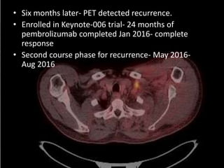 Background
• Six months later- PET detected recurrence.
• Enrolled in Keynote-006 trial- 24 months of
pembrolizumab completed Jan 2016- complete
response
• Second course phase for recurrence- May 2016-
Aug 2016
 