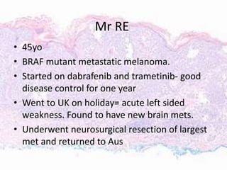Mr RE
• 45yo
• BRAF mutant metastatic melanoma.
• Started on dabrafenib and trametinib- good
disease control for one year
• Went to UK on holiday= acute left sided
weakness. Found to have new brain mets.
• Underwent neurosurgical resection of largest
met and returned to Aus
 