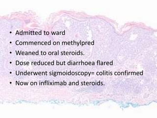 • Admitted to ward
• Commenced on methylpred
• Weaned to oral steroids.
• Dose reduced but diarrhoea flared
• Underwent sigmoidoscopy= colitis confirmed
• Now on infliximab and steroids.
 