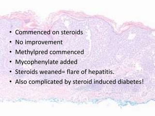 • Commenced on steroids
• No improvement
• Methylpred commenced
• Mycophenylate added
• Steroids weaned= flare of hepatitis.
• Also complicated by steroid induced diabetes!
 