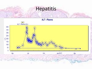 Hepatitis
 
