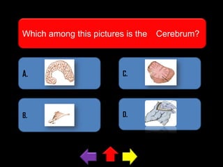 Which among this pictures is the

A.

C.

B.

D.

Cerebrum?

 